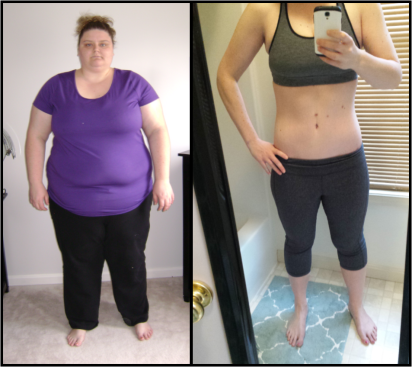 Weight Loss Calculator Gastric Sleeve